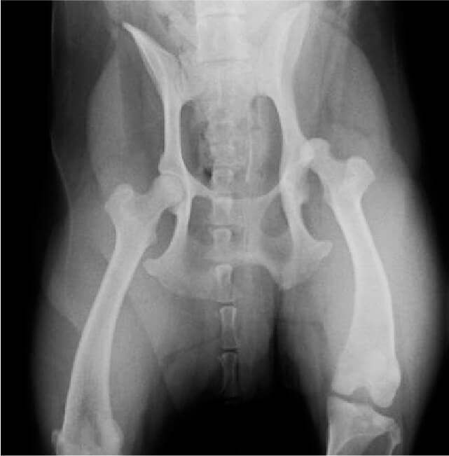 股関節脱臼（包帯法とトグルピン法）x線イメージ