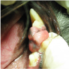 口腔腫瘍イメージ